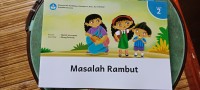 Masalah Rambut